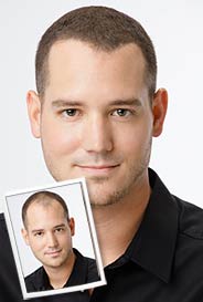 Toppik Mann Effekt 110