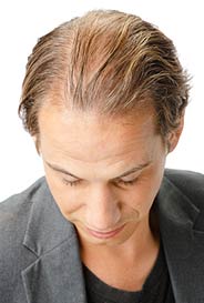 Toppik Mann ohne Effekt 161
