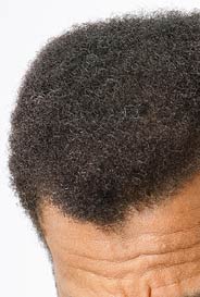 toppik mann 241 mit haarverdichtung