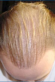 toppik mann 9
