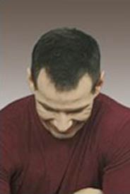 toppik mann 7 mit