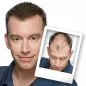 Mobile Preview: Toppik Haarverdichtung Ergebnis beim Mann