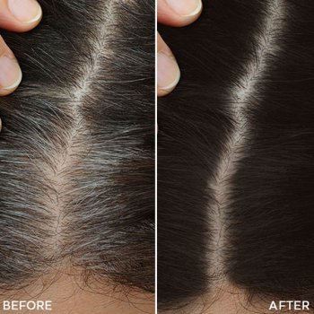 Preview: Toppik Root Touch Up Spray 98ml - Haarverdichtungsspray Preview: toppik root touch up spray vorher nachher 21