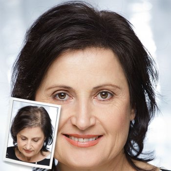 Preview: Toppik Ergebnis Frau 55-1